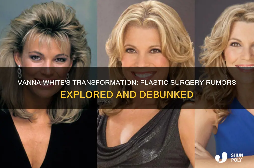did vanna white get plastic surgery