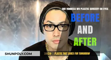 Vanness Wu's Eye Transformation: Plastic Surgery Speculations and Results
