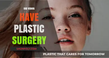 Venus' Transformation: Unveiling the Truth About Her Plastic Surgery