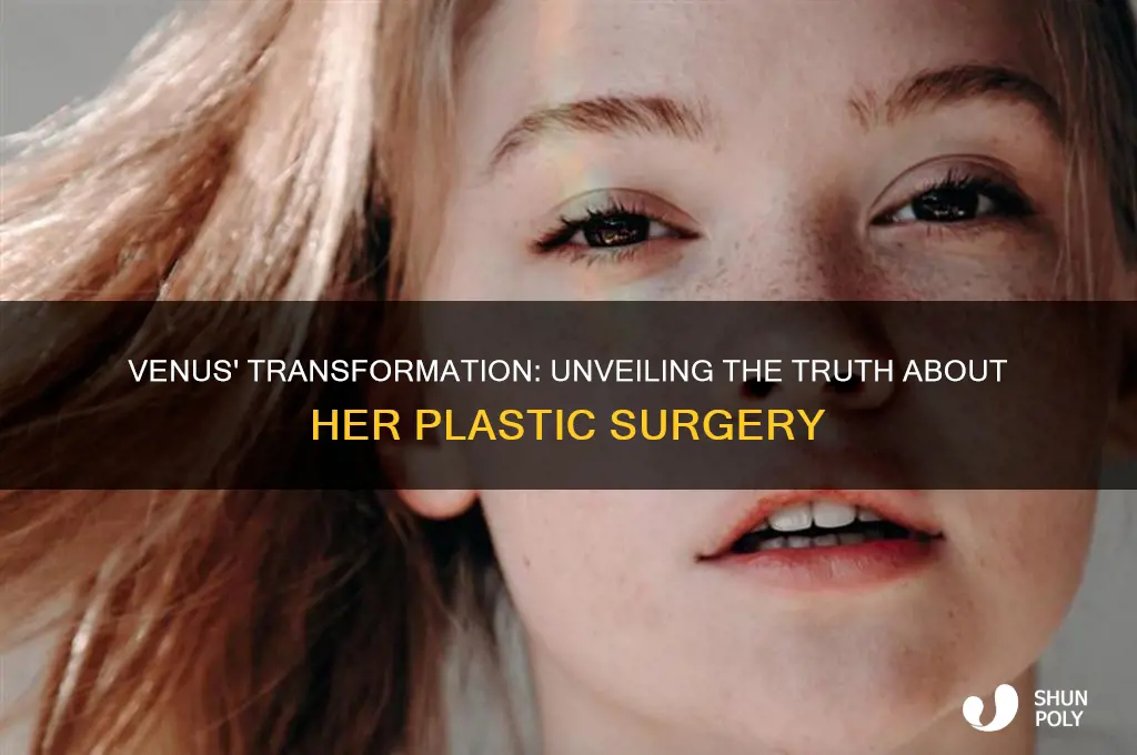 did venus have plastic surgery