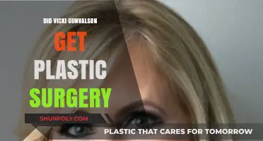 Vicki Gunvalson's Transformation: Plastic Surgery Rumors Explored