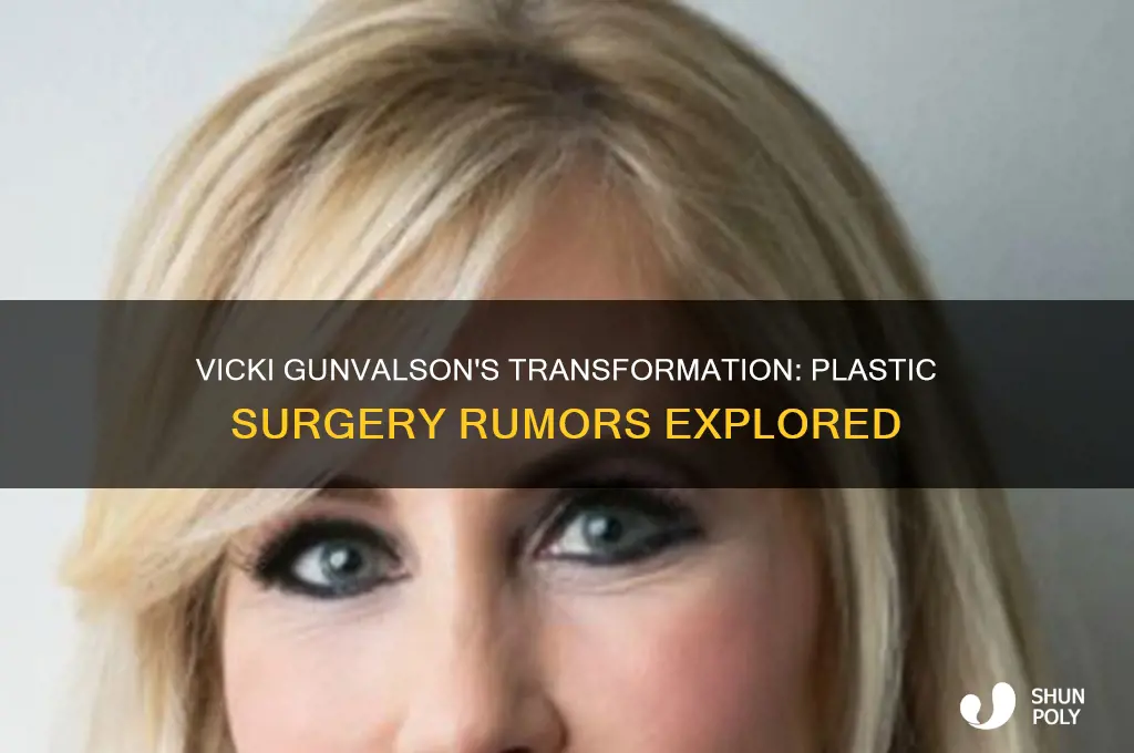 did vicki gunvalson get plastic surgery