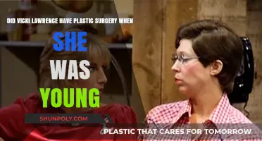 Vicki Lawrence's Youth: Plastic Surgery Speculations and Early Career Choices