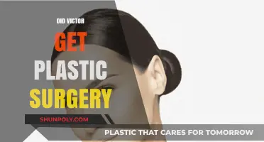 Did Victor Undergo Plastic Surgery? Unveiling the Truth Behind the Rumors
