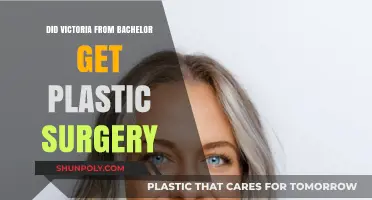 Victoria Bachelor Plastic Surgery: Fact-Checking the Rumors and Speculations