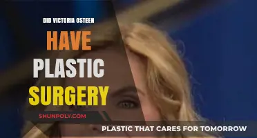 Victoria Osteen's Transformation: Plastic Surgery Rumors Explored and Debunked