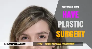 Victoria Wieck's Transformation: Plastic Surgery Rumors Explored