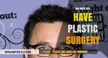 Vince Gill's Transformation: Plastic Surgery Speculations and Truths Revealed