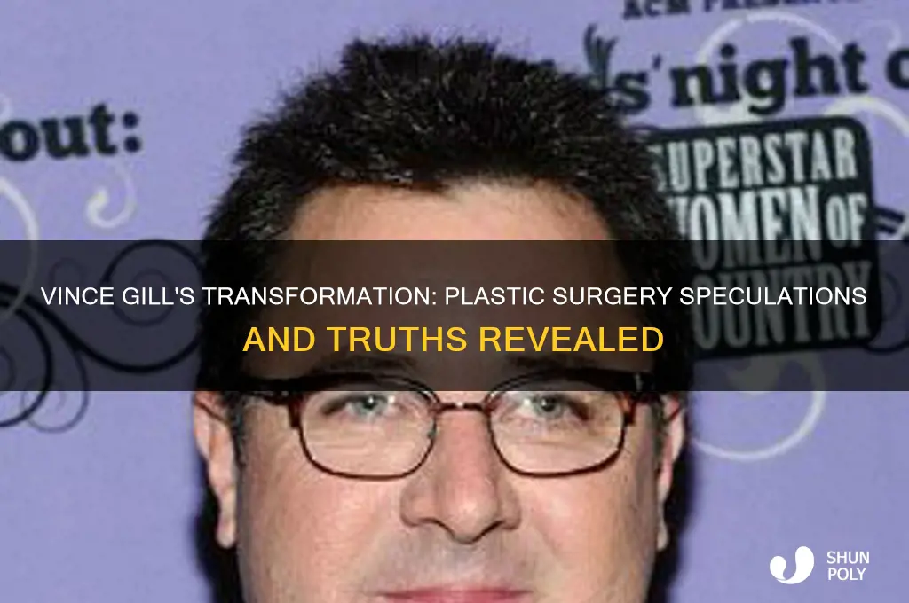 did vince gill have plastic surgery