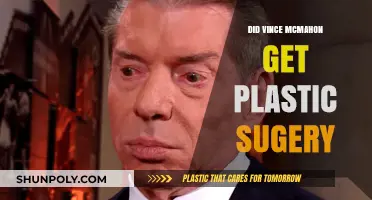 Did Vince McMahon Undergo Plastic Surgery? Unveiling the Truth