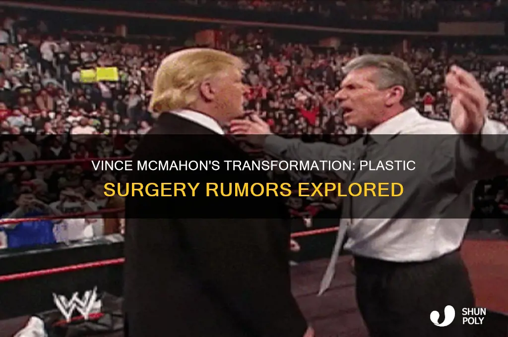did vince mcmahon get plastic surgery