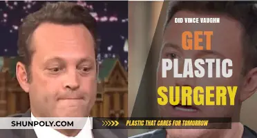 Vince Vaughn's Transformation: Plastic Surgery Rumors Explored and Debunked