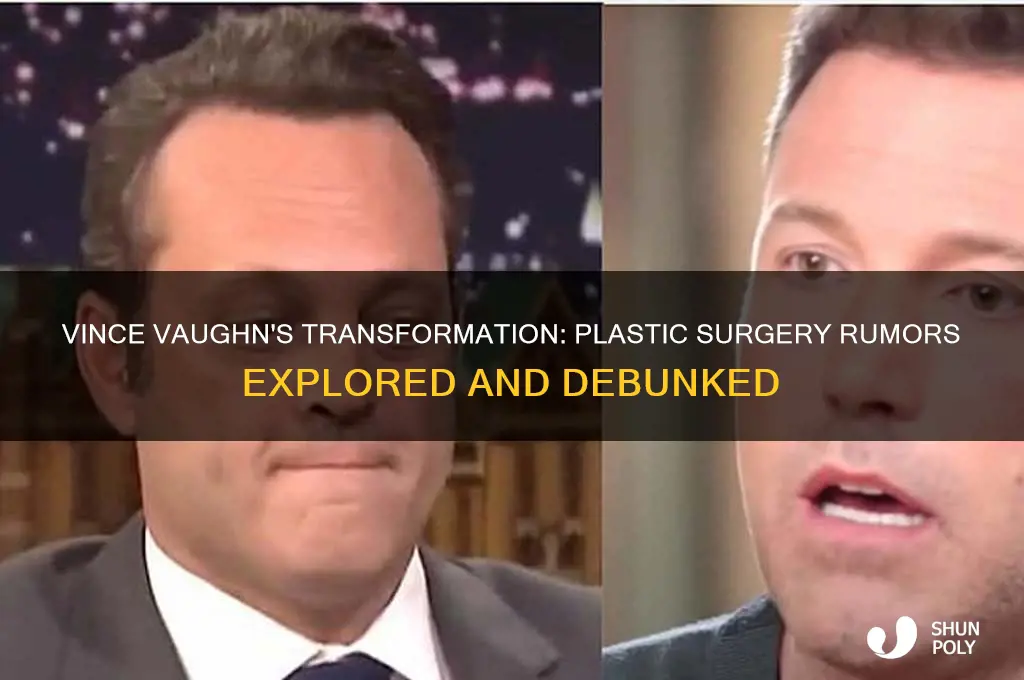 did vince vaughn get plastic surgery