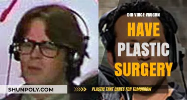 Vince Vaughn's Transformation: Plastic Surgery Rumors Explored