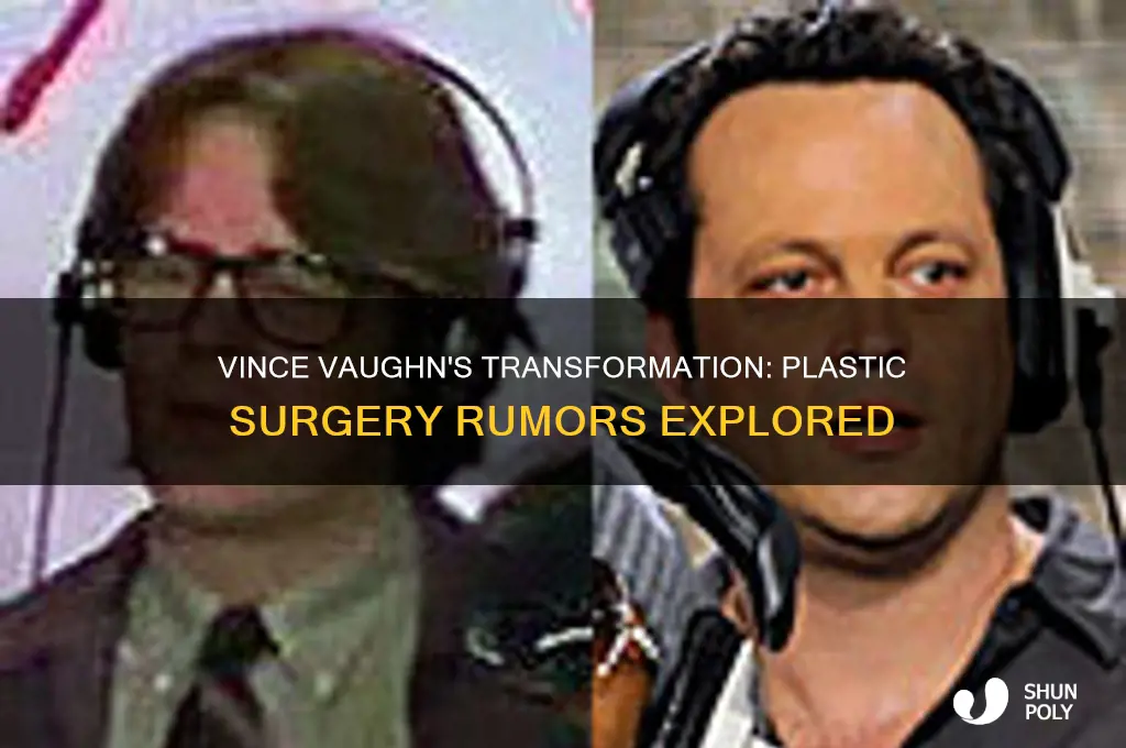 did vince vaughn have plastic surgery