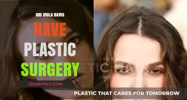 Viola Davis Plastic Surgery: Fact-Checking the Rumors and Speculations