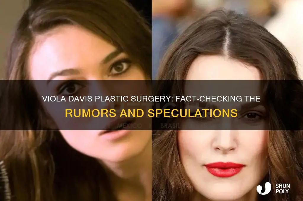 did viola davis have plastic surgery