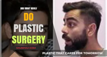 Virat Kohli Plastic Surgery Rumors: Fact or Fiction?