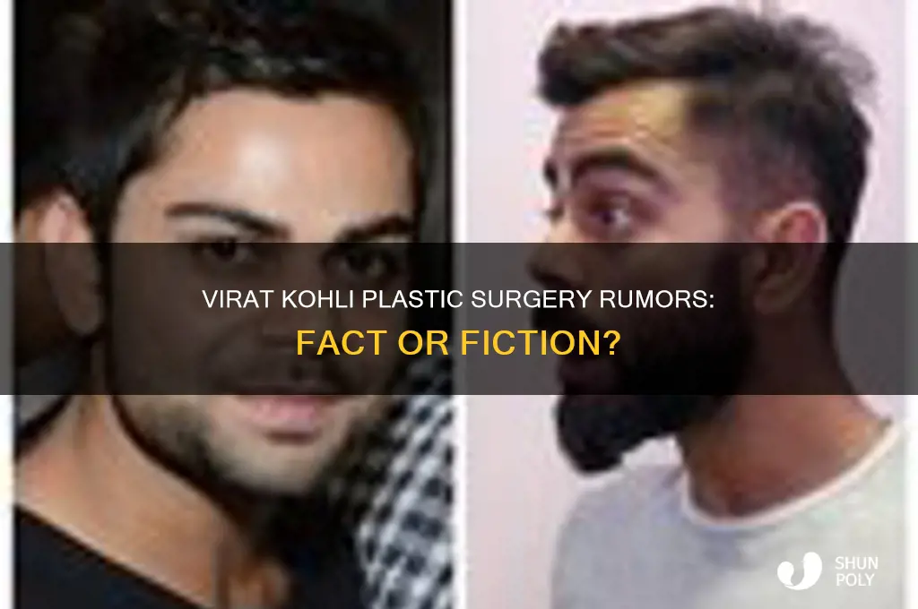 did virat kohli do plastic surgery