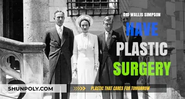 Wallis Simpson's Beauty Secrets: Plastic Surgery Rumors Explored