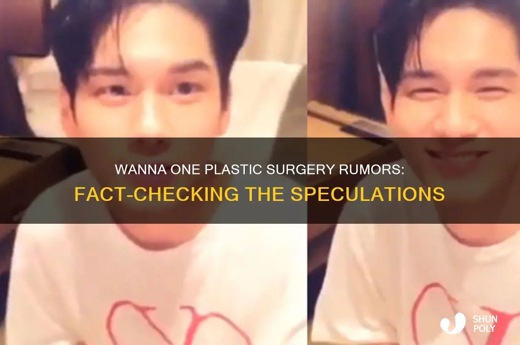 did wanna one do plastic surgery