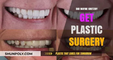 Did Wayne Gretzky Undergo Plastic Surgery? Unveiling the Truth