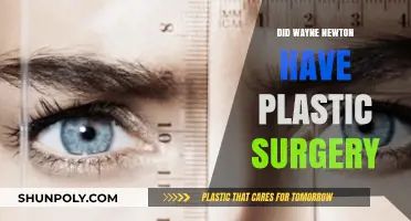 Wayne Newton's Transformation: Plastic Surgery Rumors Explored