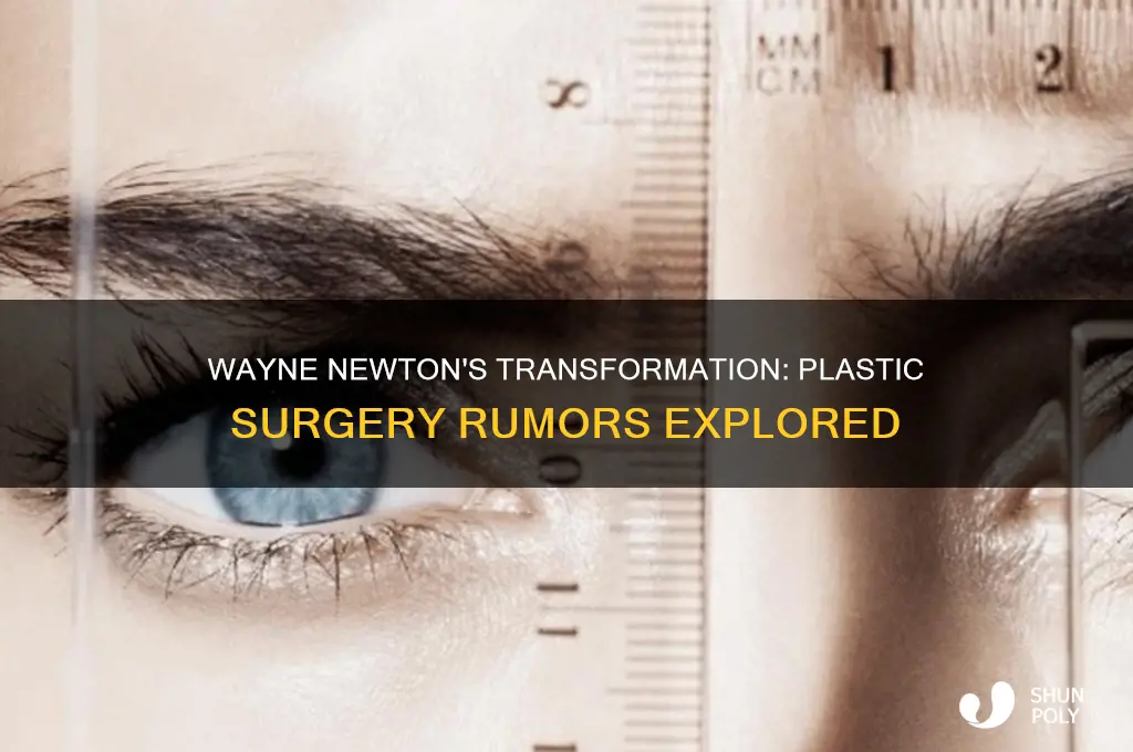 did wayne newton have plastic surgery