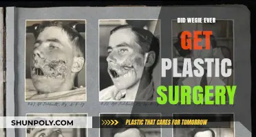 Did Wegie Undergo Plastic Surgery? Uncovering the Truth and Speculations