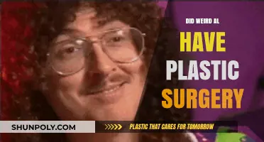 Weird Al Yankovic's Transformation: Plastic Surgery Rumors Explored
