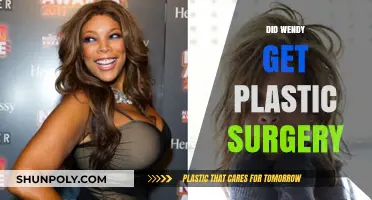 Wendy's Transformation: Unveiling the Truth About Her Plastic Surgery Rumors