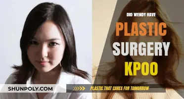 Wendy's Transformation: Plastic Surgery Rumors in K-Pop Spotlight