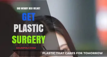 Wendy Red Velvet Plastic Surgery: Fact-Checking the Rumors and Speculations