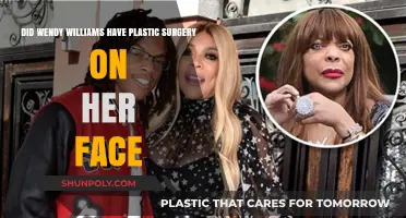 Wendy Williams' Facial Transformation: Plastic Surgery Speculations Explored