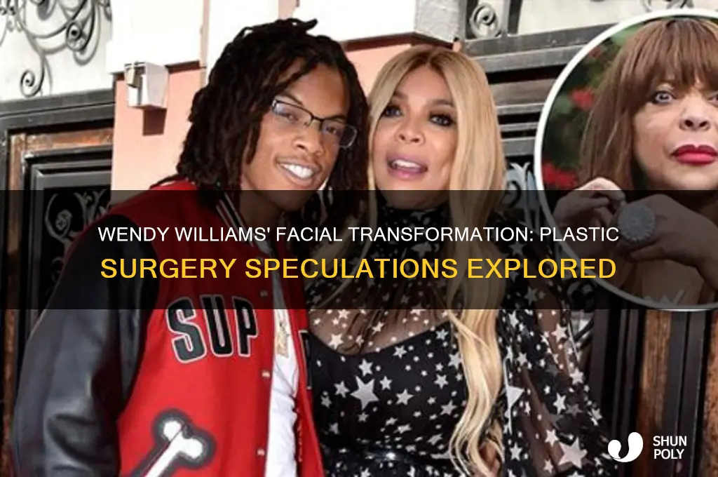 did wendy williams have plastic surgery on her face