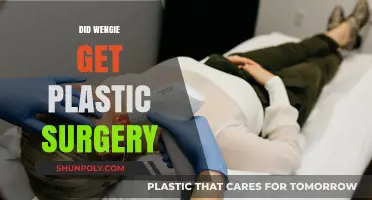 Wengie's Transformation: Uncovering the Truth About Plastic Surgery Rumors