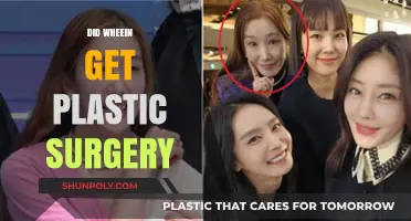 Wheein's Transformation: Plastic Surgery Rumors and the Truth Behind Them