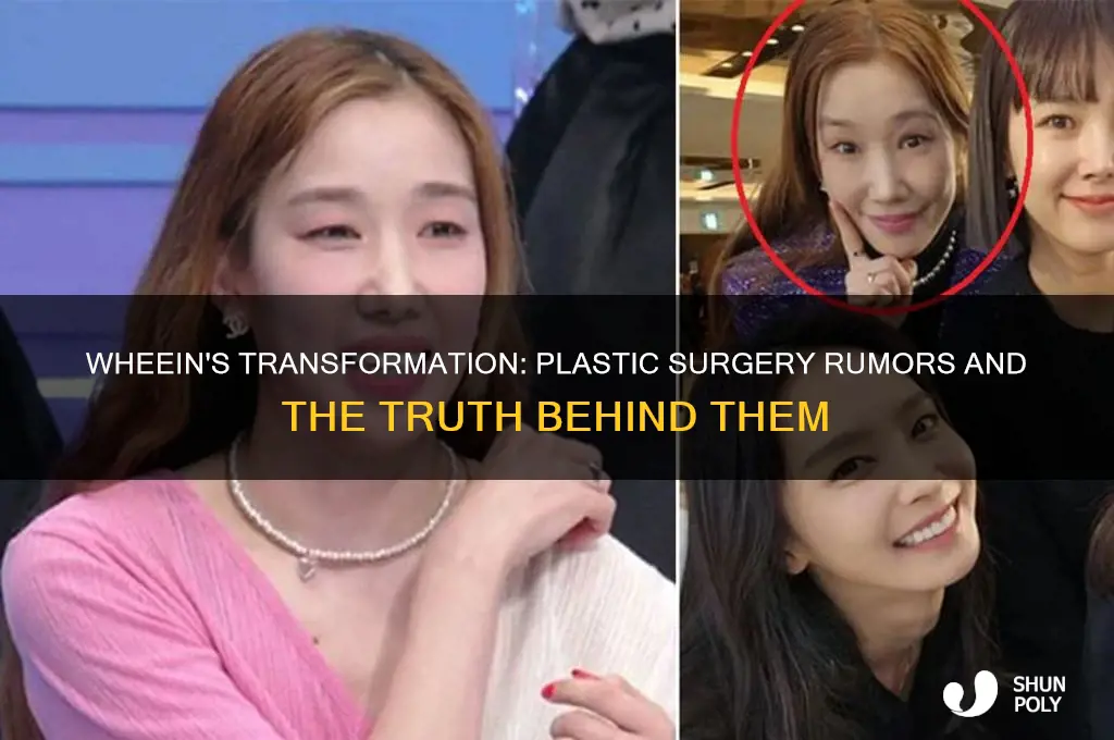 did wheein get plastic surgery