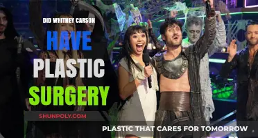 Whitney Carson's Transformation: Plastic Surgery Rumors Explored and Debunked