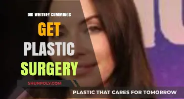 Whitney Cummings Plastic Surgery: Fact-Checking the Rumors and Speculations