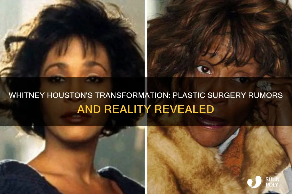 did whitney houston have plastic surgery