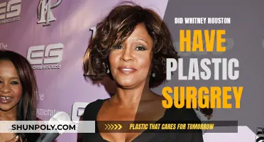 Plastic Surgery: Whitney Houston's Transformation and Procedures