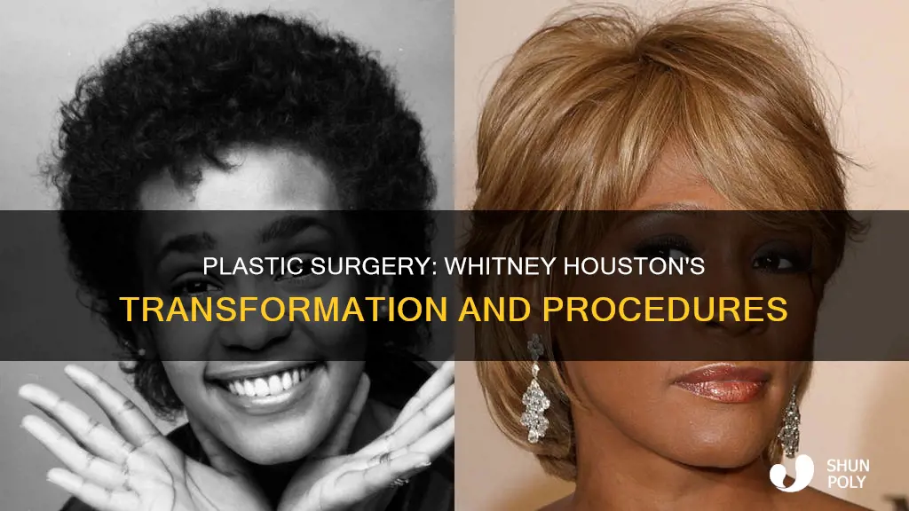 did whitney houston have plastic surgrey