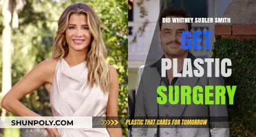 Whitney Sudler-Smith's Transformation: Plastic Surgery Speculations and Truths