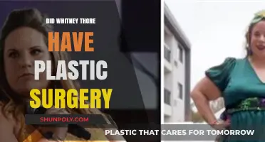 Whitney Thore Plastic Surgery: Fact-Checking the Transformation Rumors