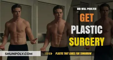 Will Poulter's Transformation: Plastic Surgery Rumors Explored