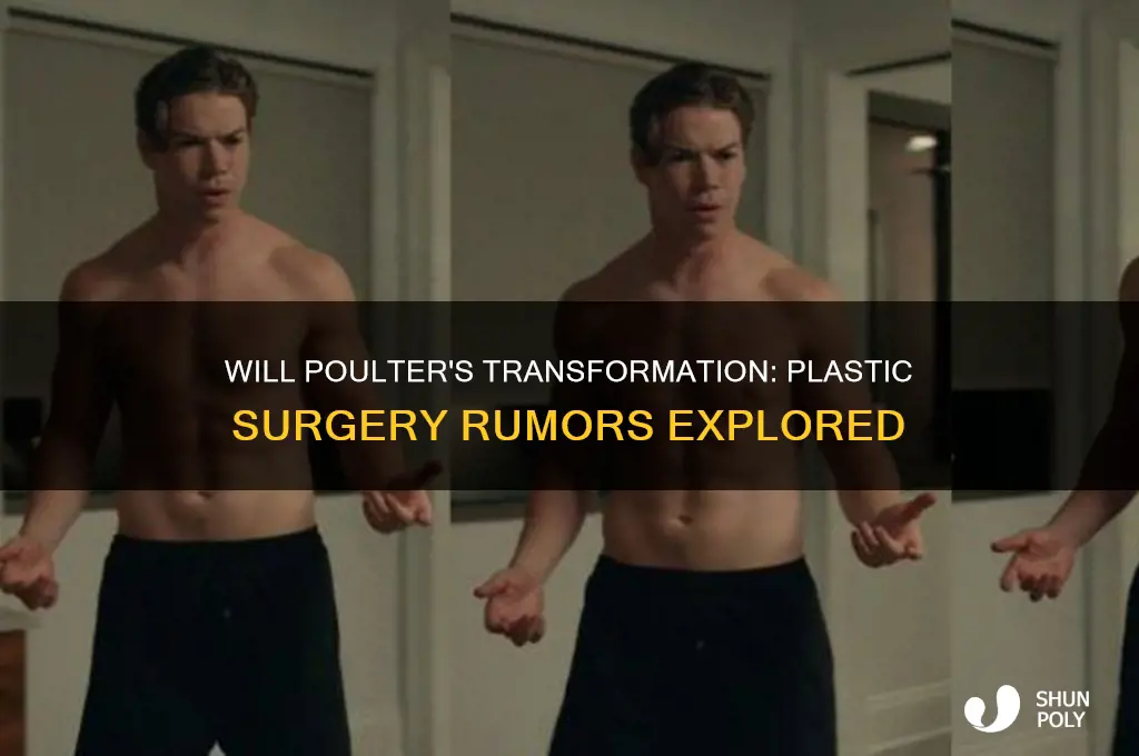 did will poulter get plastic surgery