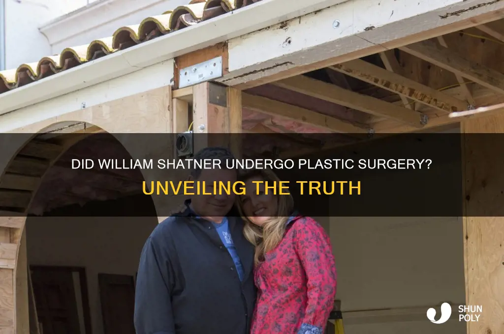 did william shatner have plastic surgery