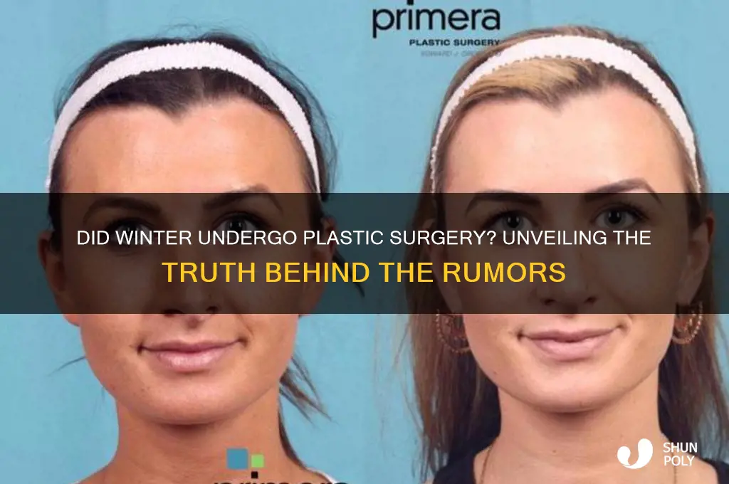 did winter do plastic surgery