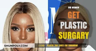 Did Women Get Plastic Surgery? Exploring Trends, Reasons, and Impacts